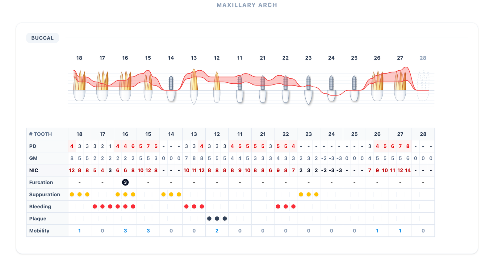 Real PerioVox periodontal chart for reviewing clinical records